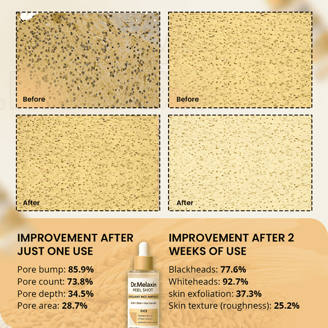 NovaLife x Dr. Melaxin Rice Peel Ampoule